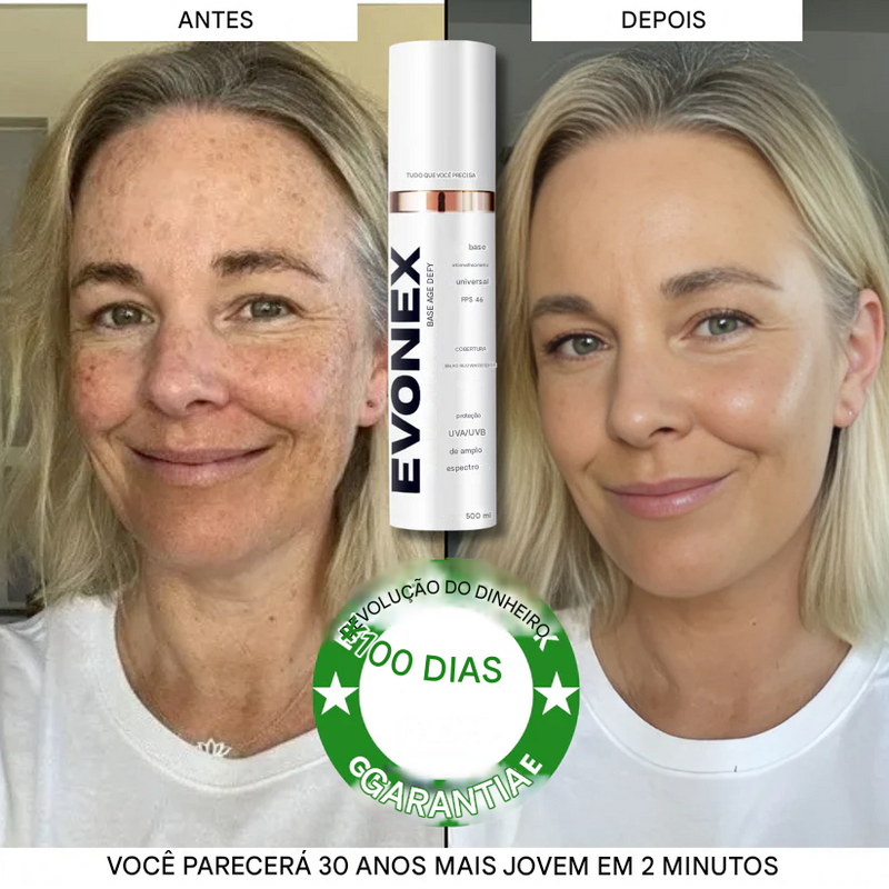 Base Evonex® Age Defy™